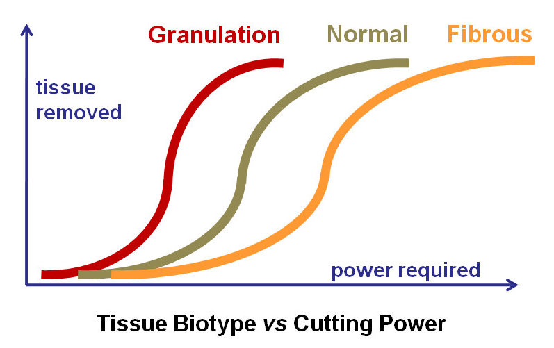 Tissue Optimized Pulse- Simpler doctor smile dental laser