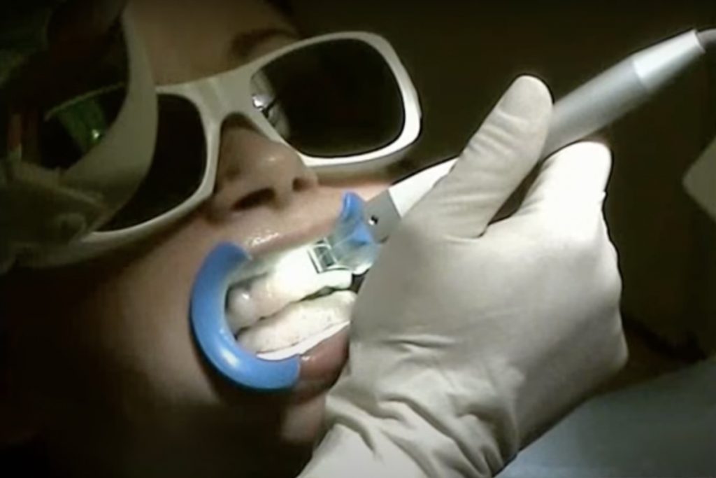 Whitening laser