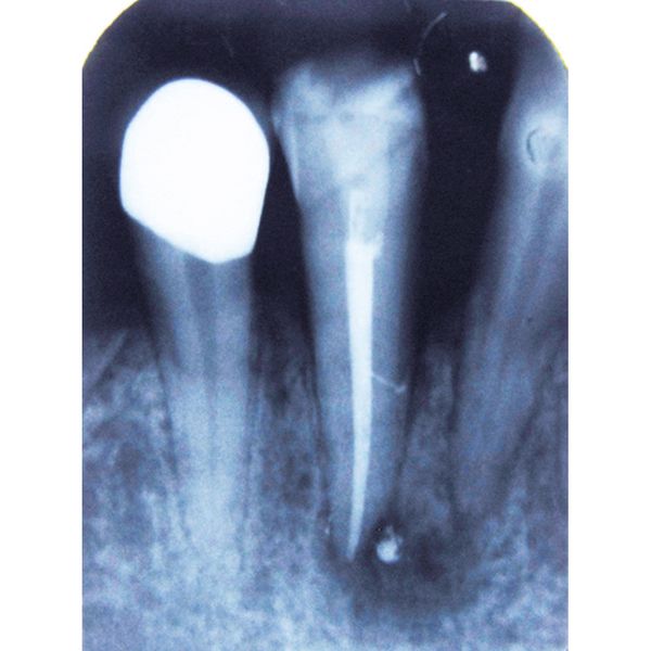 Endodonzia 1