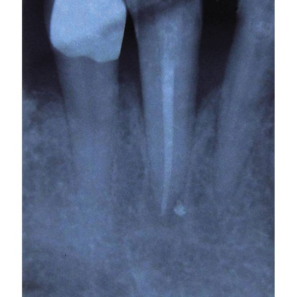 Endodonzia 3