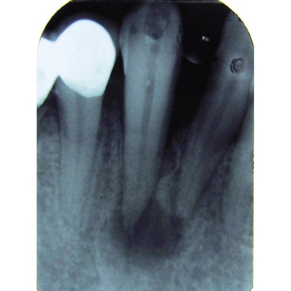 Endodonzia prima