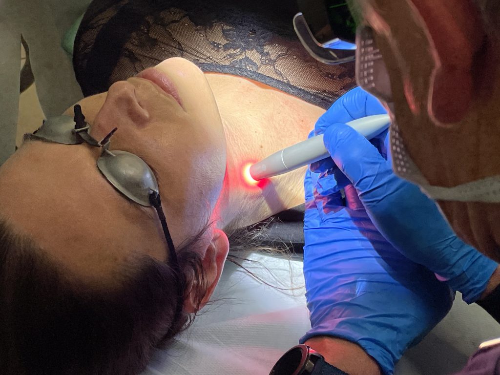 Laser a diodo in dermatologia