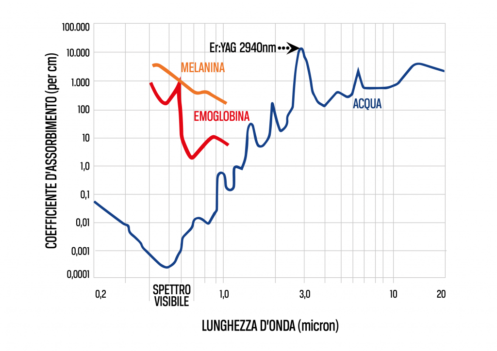 lunghezza d'onda laser 2940nm