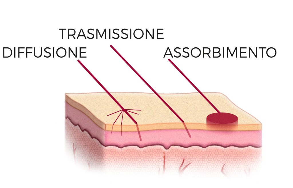 le diverse tipologie di interazione laser-tessuto