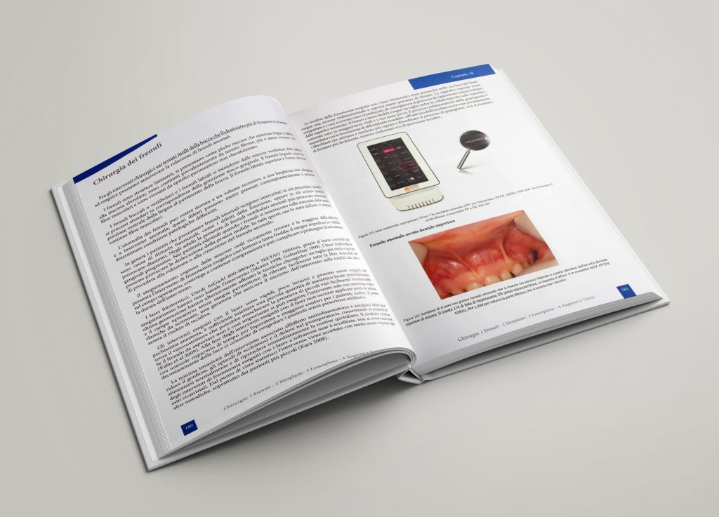 La tecnologia laser-nuova frontiera del sorriso-interno 2