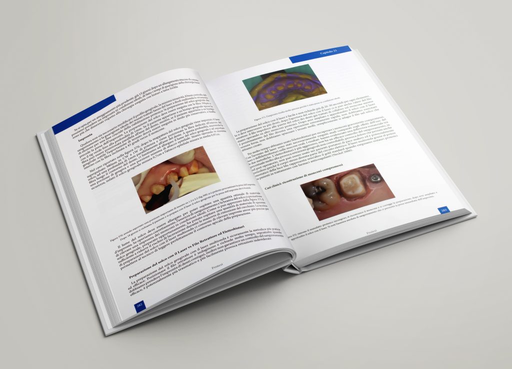 La tecnologia laser-nuova frontiera del sorriso-interno 3