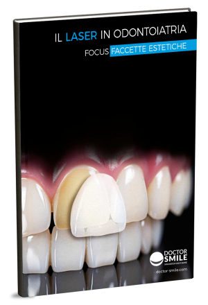 Guida faccette estetiche_anteprima